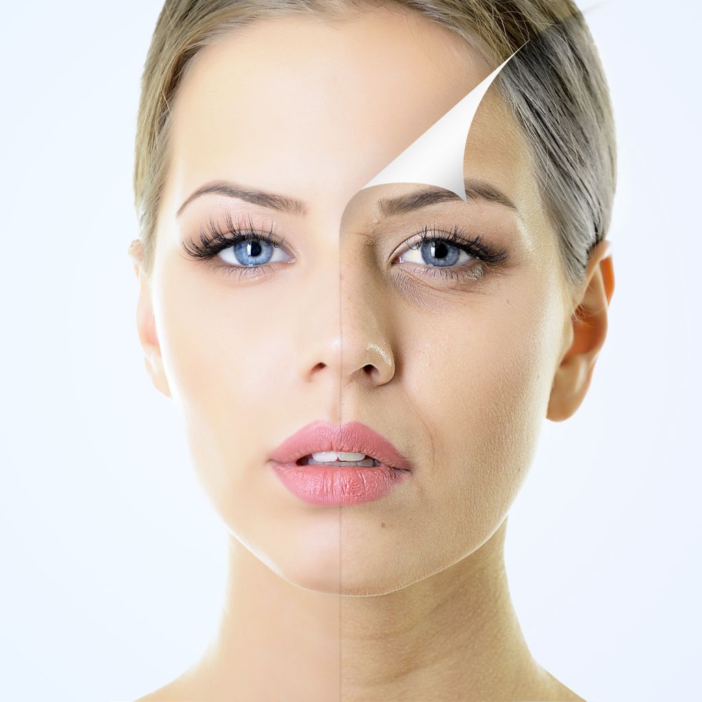 chemical-peels-treatments